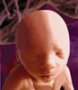 Fetus